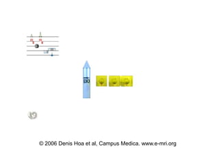 ? 2006 Denis Hoa et al, Campus Medica. www.e-mri.org
 