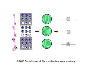 ? 2006 Denis Hoa et al, Campus Medica. www.e-mri.org
 
