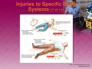 Injuries to Specific Body
Systems (7 of 14)
 