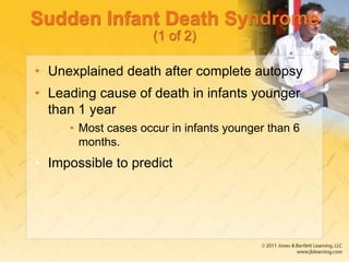Sudden Infant Death Syndrome
(1 of 2)
• Unexplained death after complete autopsy
• Leading cause of death in infants younger
than 1 year
• Most cases occur in infants younger than 6
months.
• Impossible to predict
 