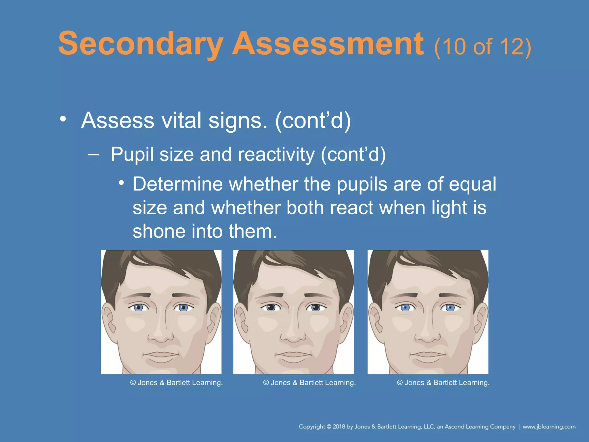 • Assess vital signs. (cont’d)
– Pupil size and reactivity (cont’d)
• Determine whether the pupils are of equal
size and whether both react when light is
shone into them.
Secondary Assessment (10 of 12)
© Jones & Bartlett Learning. © Jones & Bartlett Learning. © Jones & Bartlett Learning.
 