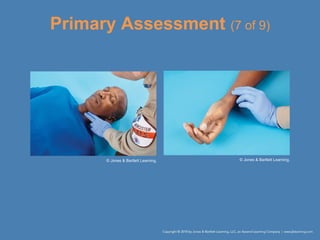 Primary Assessment (7 of 9)
© Jones & Bartlett Learning. © Jones & Bartlett Learning.
 