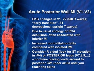 Acute Posterior Wall MI (V1-V2)
• EKG changes in V1, V2 (tall R waves;
  “early transition”, ST
  depressions, upright T waves)
• Due to usual etiology of RCA
  occlusion, often associated with
  inferior MI
• Increased morbidity/mortality
  compared with isolated IMI
• Consider R sided (look for ST elevation
  in rV4) or POSTERIOR leads (V7,8,9,…)
  – continue placing leads around to
  posterior CW under axilla until you
  reach the spine
 