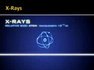  They are shorter in wavelength than UV rays and longer
than gamma rays.
 The discoverer of X-Rays, Wilhelm Conrad Röntgen had
named it X-radiation to signify an unknown type of
radiation.
 X-rays carry great deal of
energy and can travel through
a variety of materials.
 In universe,X-rays are emitted
by pulsars, black holes
supernovas
 