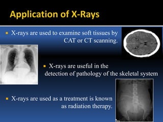  X-rays are used to examine soft tissues by
CAT or CT scanning.
 X-rays are useful in the
detection of pathology of the skeletal system
 X-rays are used as a treatment is known
as radiation therapy.
 