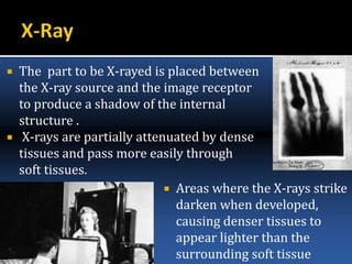  The part to be X-rayed is placed between
the X-ray source and the image receptor
to produce a shadow of the internal
structure .
 X-rays are partially attenuated by dense
tissues and pass more easily through
soft tissues.
 Areas where the X-rays strike
darken when developed,
causing denser tissues to
appear lighter than the
surrounding soft tissue
 
