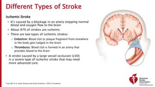 Different Types of Stroke
Ischemic Stroke
• It’s caused by a blockage in an artery stopping normal
blood and oxygen flow to the brain
• About 87% of strokes are ischemic
• There are two types of ischemic strokes:
o Embolism: Blood clot or plaque fragment from elsewhere
in the body gets lodged in the brain
o Thrombosis: Blood clot is formed in an artery that
provides blood to the brain
• A stroke caused by a large vessel occlusion (LVO)
is a severe type of ischemic stroke that may need
more advanced care.
Tsao CW, et al. Heart Disease and Stroke Statistics. (2022) Circulation.
 