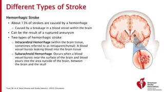 Different Types of Stroke
Hemorrhagic Stroke
• About 13% of strokes are caused by a hemorrhage
o Caused by a breakage in a blood vessel within the brain
• Can be the result of a ruptured aneurysm
• Two types of hemorrhagic stroke:
o Intracerebral Hemorrhage (within the brain tissue,
sometimes referred to as intraparenchymal): A blood
vessel bursts leaking blood into the brain tissue
o Subarachnoid Hemorrhage: Occurs when a blood
vessel bursts near the surface of the brain and blood
pours into the area outside of the brain, between
the brain and the skull
Tsao CW, et al. Heart Disease and Stroke Statistics. (2022) Circulation.
 