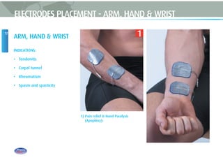 12
ARM, HAND & WRIST
INDICATIONS:
• Tendonitis
• Carpal tunnel
• Rheumatism
• Spasm and spasticity
1) Pain relief & Hand Paralysis
(Apoplexy):
ELECTRODES PLACEMENT - ARM, HAND & WRIST
1
 