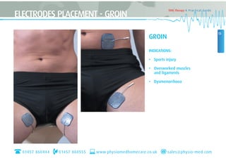 13
TENS Therapy A Practical Guide
GROIN
INDICATIONS:
• Sports injury
• Overworked muscles
and ligaments
• Dysmenorrhoea
ELECTRODES PLACEMENT - GROIN
01457 860444 01457 860555 www.physiomedhomecare.co.uk sales@physio-med.com
 