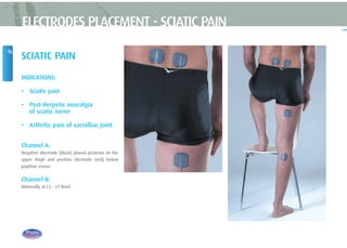 SCIATIC PAIN
INDICATIONS:
• Sciatic pain
• Post-Herpetic neuralgia
of sciatic nerve
• Arthritic pain of sacrolliac joint
Channel A:
Negative electrode (black) placed posterior on the
upper thigh and positive electrode (red) below
poplitae crease.
Channel B:
Bilaterally at L5 - S1 level.
16
ELECTRODES PLACEMENT - SCIATIC PAIN
 
