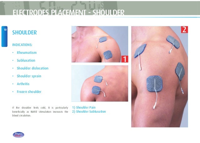 ipulse pad placement shoulder ipulse pad placement shoulder