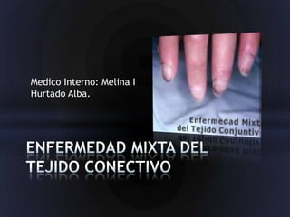Medico Interno: Melina I
Hurtado Alba.
 