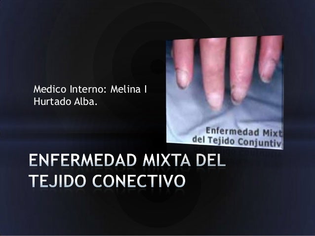 Enfermedad Mixta Del Tejido Conectivo - 