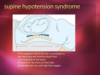 The pregnant uterus acts like a tourniquet to
the vena cava and restricts blood from
returning back to the heart.
  Treatment: flip them on their side.
(preferably left side with high flow oxygen.
 