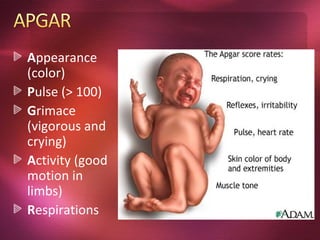 Appearance
(color)
Pulse (> 100)
Grimace
(vigorous and
crying)
Activity (good
motion in
limbs)
Respirations
 