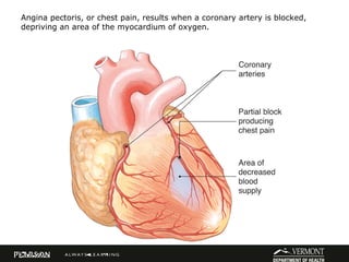 EMT Cardiovascular ACS | PPT