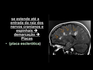 se estende até a
entrada da raiz dos
nervos cranianos e
espinhais !
demarcação !
Placas
• (placa esclerótica)
 