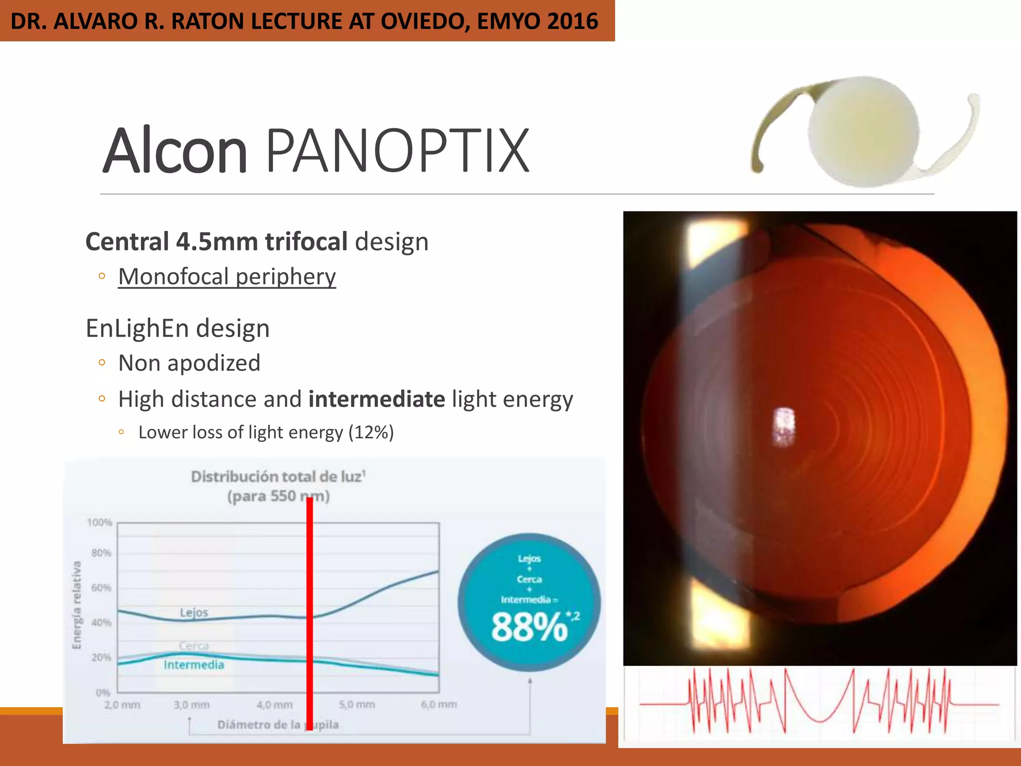 Update in intraocular lenses | PPTX
