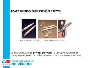 TRATAMIENTO DISFUNCIÓN ERÉCTIL
La implantación de prótesis peneana se propone raramente,
aunque puede ser una alternativa en casos muy seleccionados
 