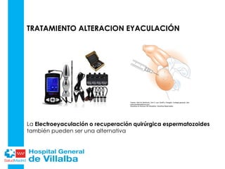 TRATAMIENTO ALTERACION EYACULACIÓN
La Electroeyaculación o recuperación quirúrgica espermatozoides
también pueden ser una alternativa
 