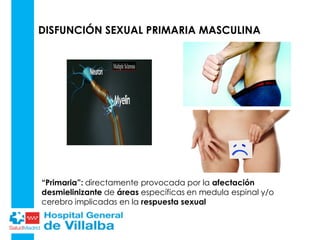 DISFUNCIÓN SEXUAL PRIMARIA MASCULINA
“Primaria”: directamente provocada por la afectación
desmielinizante de áreas específicas en medula espinal y/o
cerebro implicadas en la respuesta sexual
 