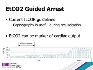 EtCO2 Guided Arrest
• Current ILCOR guidelines
– Capnography is useful during resuscitation
• EtCO2 can be marker of cardiac output
 