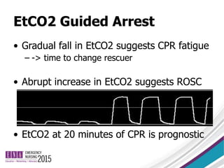 EtCO2 Guided Arrest
• Gradual fall in EtCO2 suggests CPR fatigue
– -> time to change rescuer
• Abrupt increase in EtCO2 suggests ROSC
• EtCO2 at 20 minutes of CPR is prognostic
 