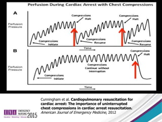 Cunningham et al. Cardiopulmonary resuscitation for
cardiac arrest: The importance of uninterrupted
chest compressions in cardiac arrest resuscitation.
American Journal of Emergency Medicine, 2012
 