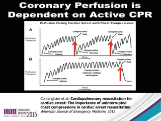 Cunningham et al. Cardiopulmonary resuscitation for
cardiac arrest: The importance of uninterrupted
chest compressions in cardiac arrest resuscitation.
American Journal of Emergency Medicine, 2012
 