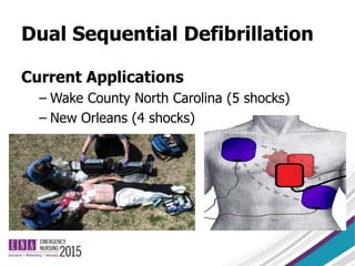 Dual Sequential Defibrillation
Current Applications
– Wake County North Carolina (5 shocks)
– New Orleans (4 shocks)
 