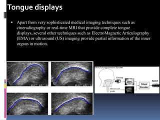 Tongue displays
 Apart from very sophisticated medical imaging techniques such as
   cineradiography or real-time MRI that provide complete tongue
   displays, several other techniques such as ElectroMagnetic Articulography
   (EMA) or ultrasound (US) imaging provide partial information of the inner
   organs in motion.
 