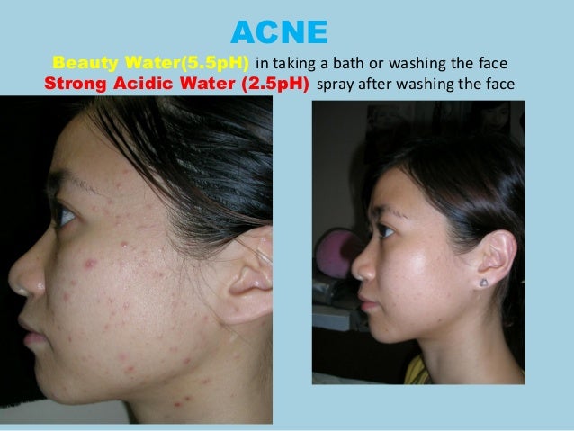 kangen beauty water for face