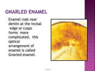  Enamel rods near
dentin at the incisal
edge or cusps
forms more
complicated, this
optical
arrangement of
enamel is called
Gnarled enamel.
9/16/2014
 