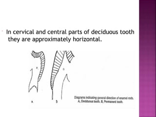  In cervical and central parts of deciduous tooth
they are approximately horizontal.
 