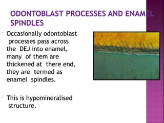  Occasionally odontoblast
processes pass across
the DEJ into enamel,
many of them are
thickened at there end,
they are termed as
enamel spindles.
 This is hypomineralised
structure.
 