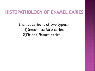 Enamel caries is of two types:-
1)Smooth surface caries
2)Pit and fissure caries
 
