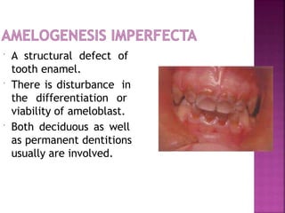  A structural defect of
tooth enamel.
 There is disturbance in
the differentiation or
viability of ameloblast.
 Both deciduous as well
as permanent dentitions
usually are involved.
 