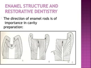  The direction of enamel rods is of
importance in cavity
preparation:
 