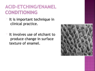  It is important technique in
clinical practice.
 It involves use of etchant to
produce change in surface
texture of enamel.
 