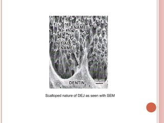 Scalloped nature of DEJ as seen with SEM 