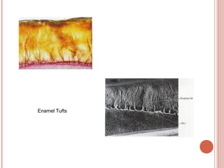 Enamel Tufts 