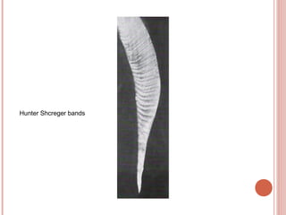 Hunter Shcreger bands 