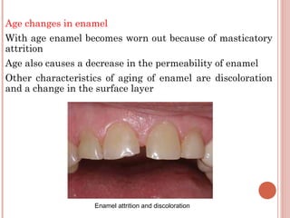 Age changes in enamel With age enamel becomes worn out because of masticatory attrition Age also causes a decrease in the permeability of enamel Other characteristics of aging of enamel are discoloration and a change in the surface layer Enamel attrition and discoloration 