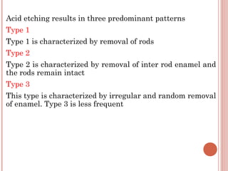 Acid etching results in three predominant patterns Type 1 Type 1 is characterized by removal of rods Type 2 Type 2 is characterized by removal of inter rod enamel and the rods remain intact Type 3 This type is characterized by irregular and random removal of enamel. Type 3 is less frequent 