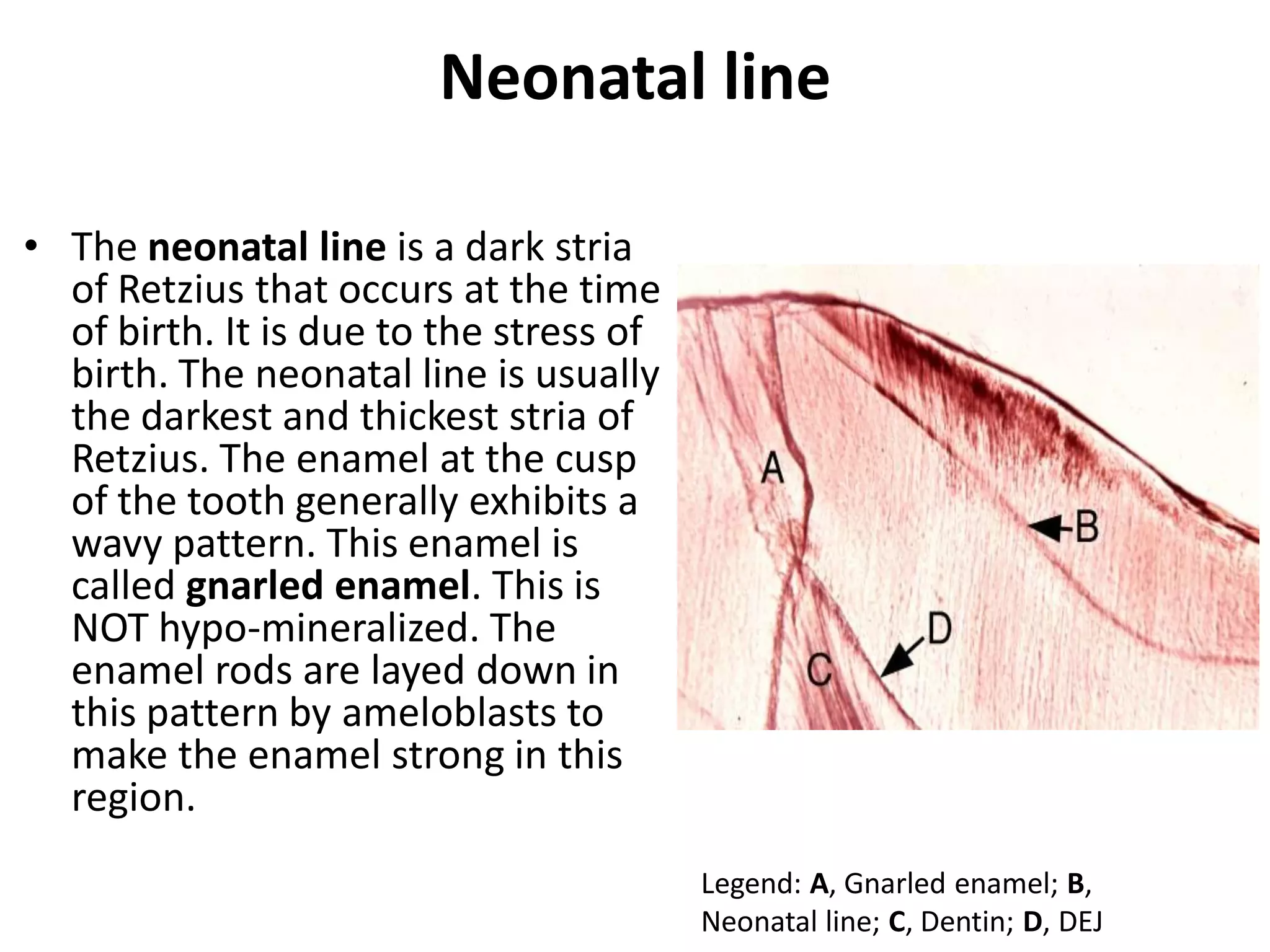 Tooth Retzius Enamel | PDF