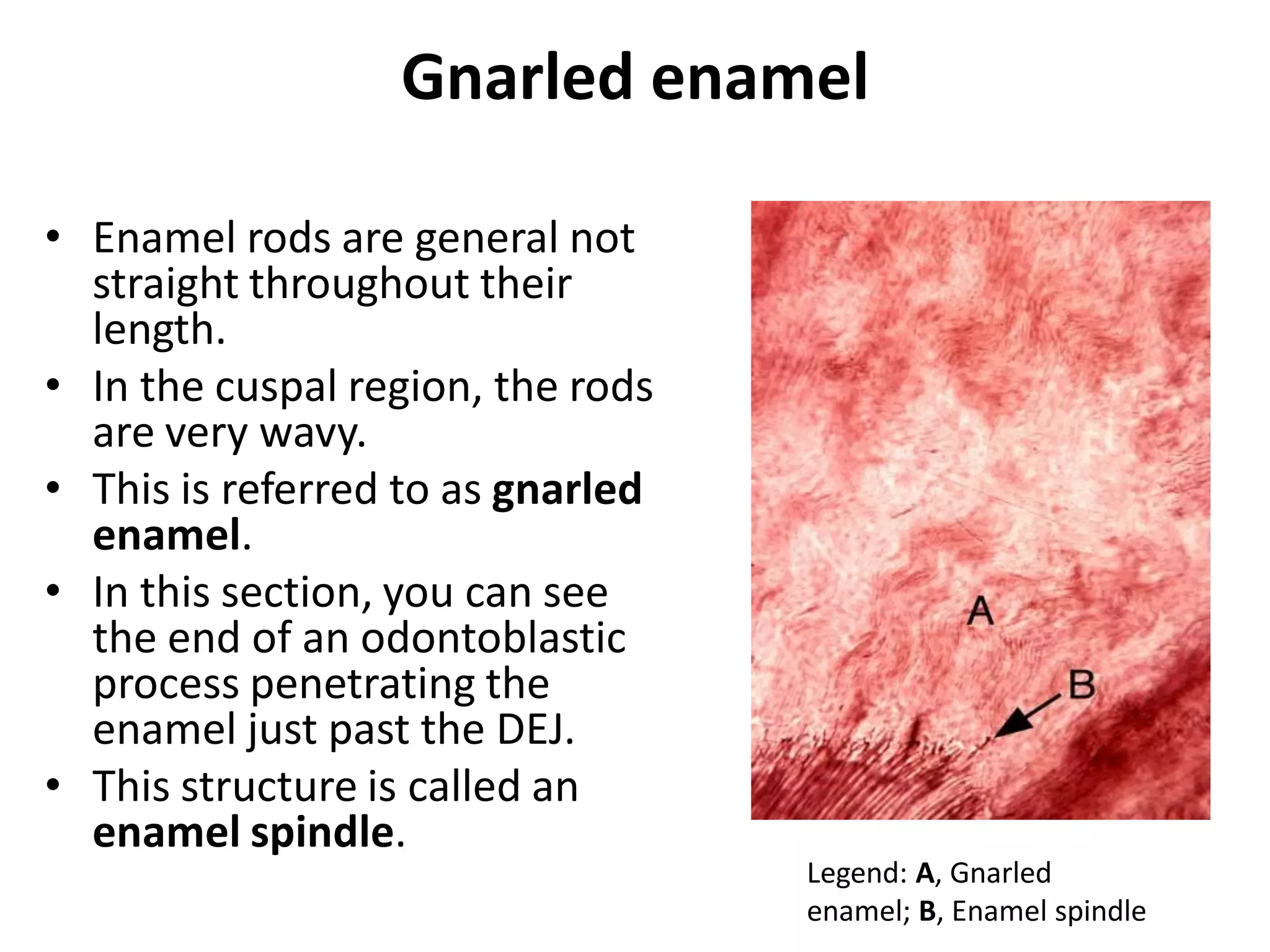 Enamelon Rods Enamel | PDF