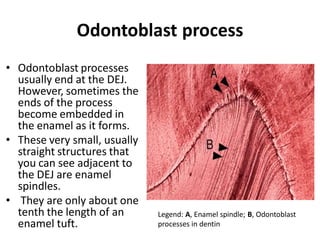 Odontoblast process
• Odontoblast processes
usually end at the DEJ.
However, sometimes the
ends of the process
become embedded in
the enamel as it forms.
• These very small, usually
straight structures that
you can see adjacent to
the DEJ are enamel
spindles.
• They are only about one
tenth the length of an
enamel tuft.
Legend: A, Enamel spindle; B, Odontoblast
processes in dentin
 