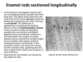 Enamel rods sectioned longitudinally
• In this electron micrograph enamel rods
are cut longitudinally (in parallel with their
long axis). The ligher band represents the
inner part of the rod or rod core, while the
darker part represents the outer covering
or rod sheath. This difference in
appearance is caused by the packing
density of the rod hydroxyapatite crystals.
In the core the crystals are packed in
parallel with one another and tightly
together (very mineralized), whereas in
the rod sheath, the crystals are lossly
packed and are oriented at variable angles
to one another with organic material
interspersed (less mineralized). In this
particular section, the cores are narrow
and the sheaths wide, signifying that this
area is taken from a dark cross-striation or
stria of Retzius.
• Note that the rod sheaths are shared by
two adjacent rods.
Legend: A, Rod sheath; B, Rod core
 