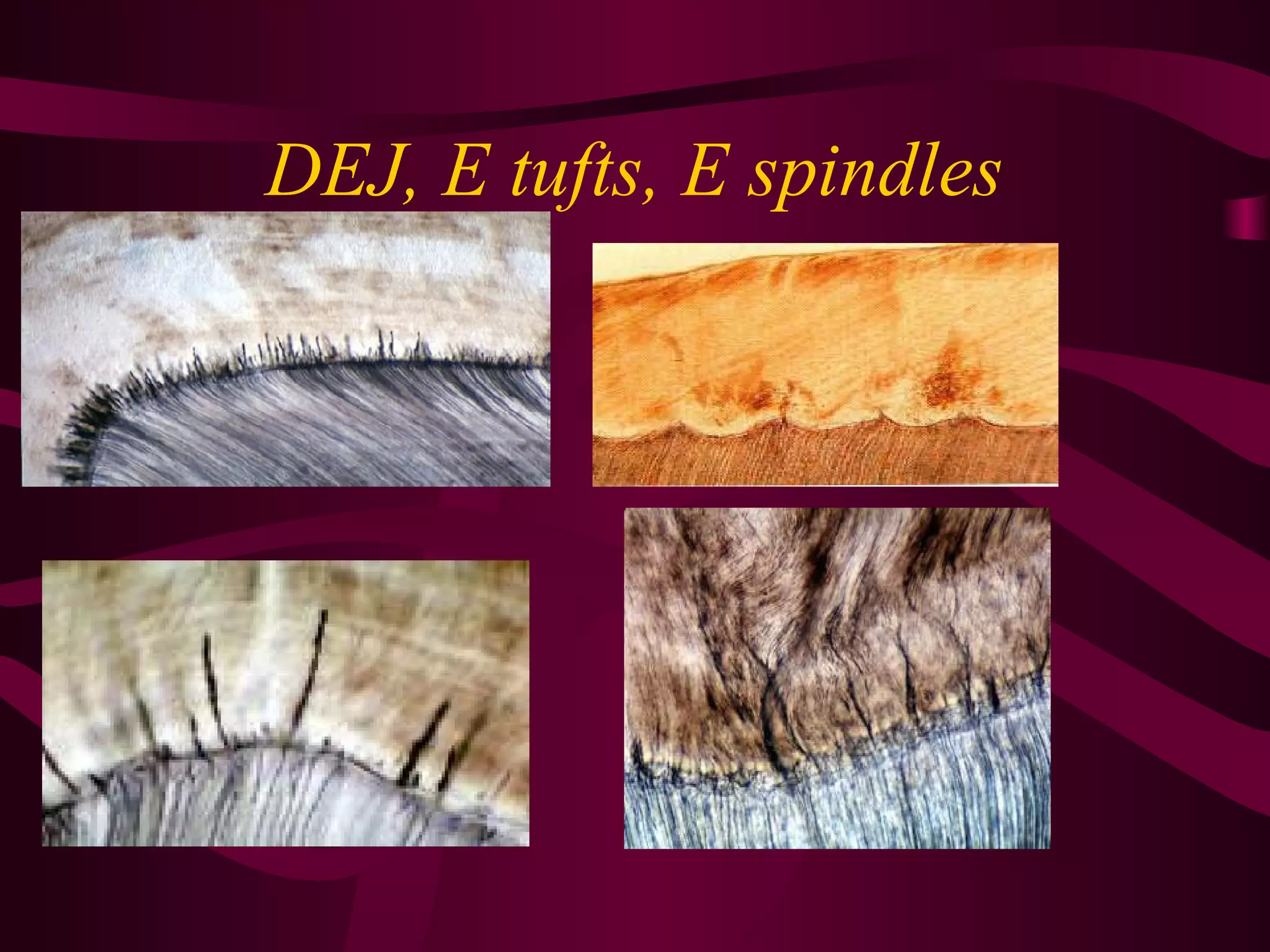 Histology of Enamel | PPT